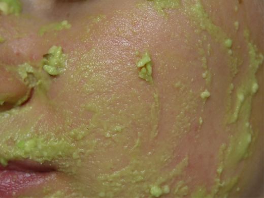 Avokado Yüz Maskesi ve Malzemeleri